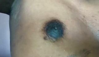 This is chest or B